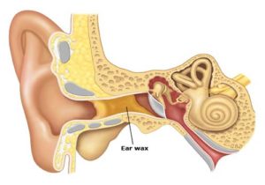 Ear Wax Myths And Facts
